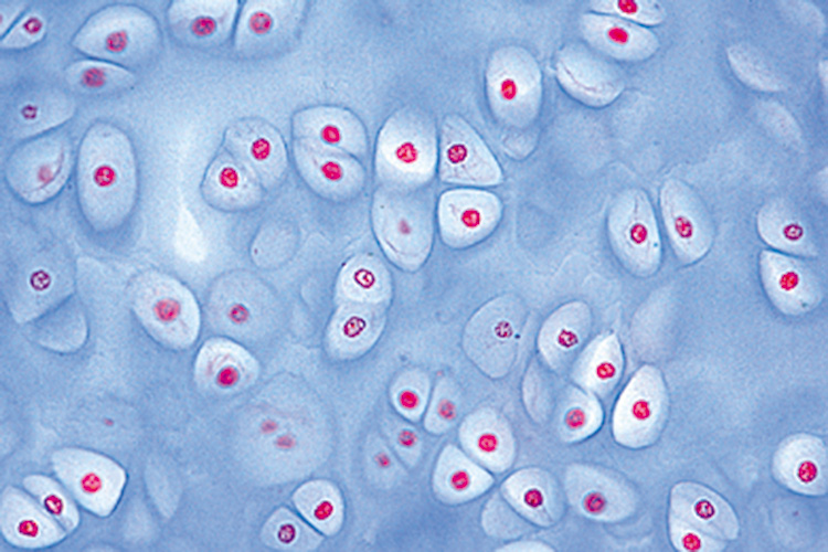 Hyalien kraakbeen T.S. (preparaat)