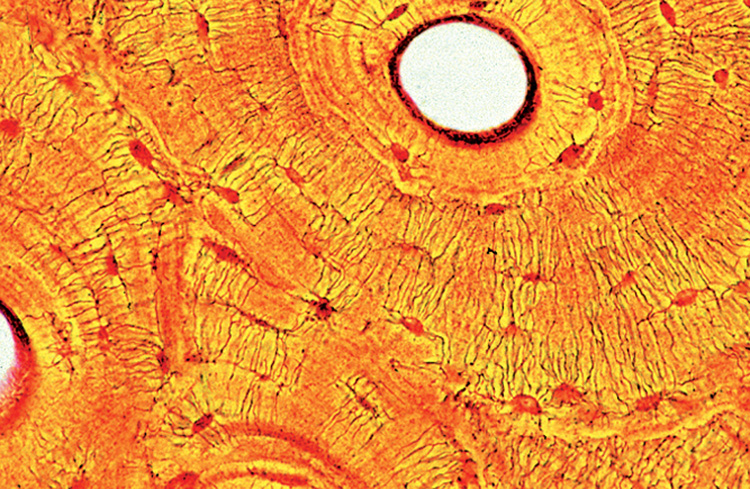 Compact bot rund T.S. (preparaat)