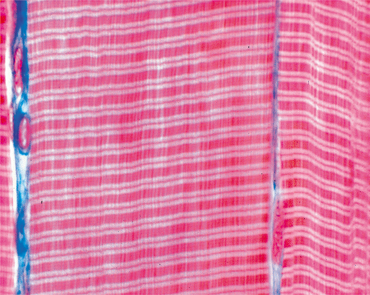 Dwarsgestreept spierweefsel (preparaat)