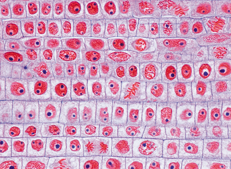 Mitose worteltop ui T.S. (preparaat)