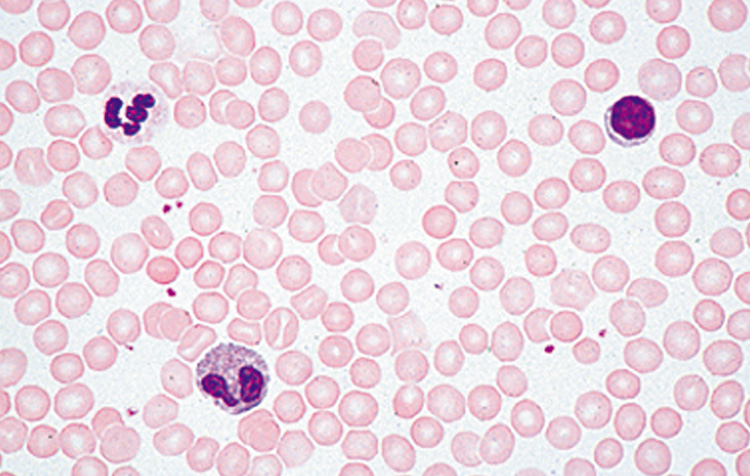 Menselijk bloeduitstrijkje (preparaat)