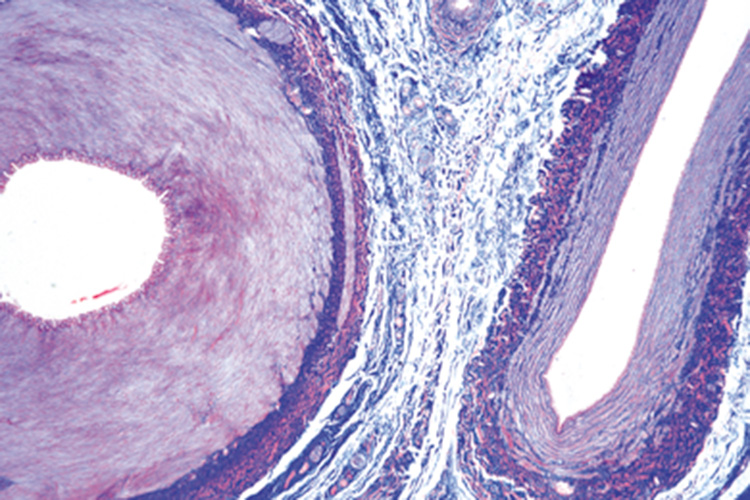 Slagader en ader T.S. (preparaat)