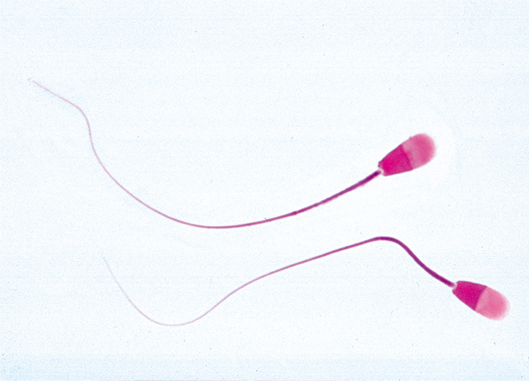 Uitstrijkje sperma mens (preparaat)