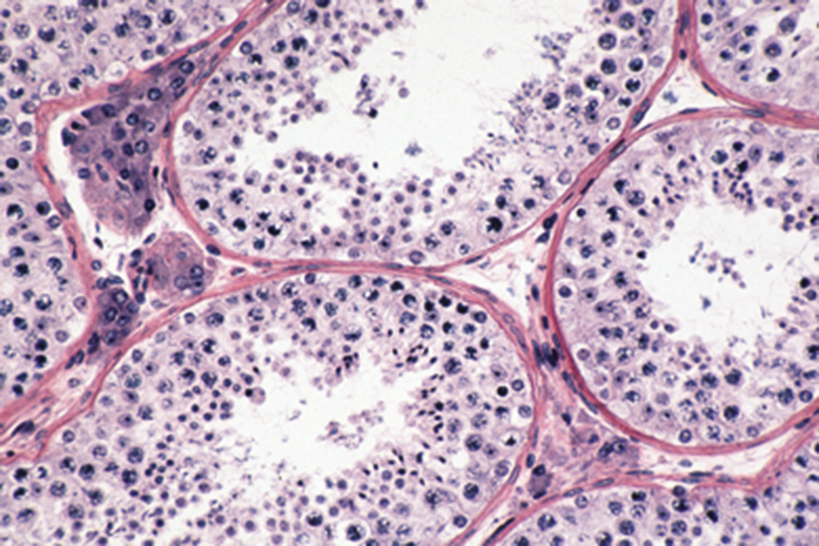Meiose testis muis (preparaat)