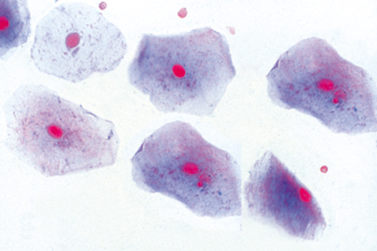Wangslijmvlies (preparaat)